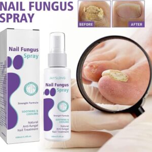 Nail Repair Spray for Damaged Nails – Advanced Antifungal Treatment for Toenails & Fingernails – Restores, Strengthens, and Promotes Healthy Nail Growth – 100ml Foot & Nail Care Solution