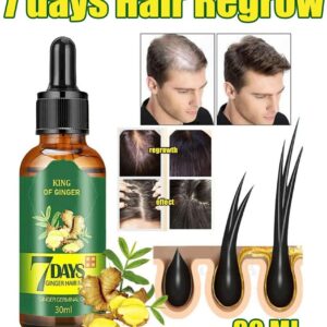 Hair Growth Serum With Ginger, Fast Regrowth Oil, Anti-Loss Treatment Essence [30ml]